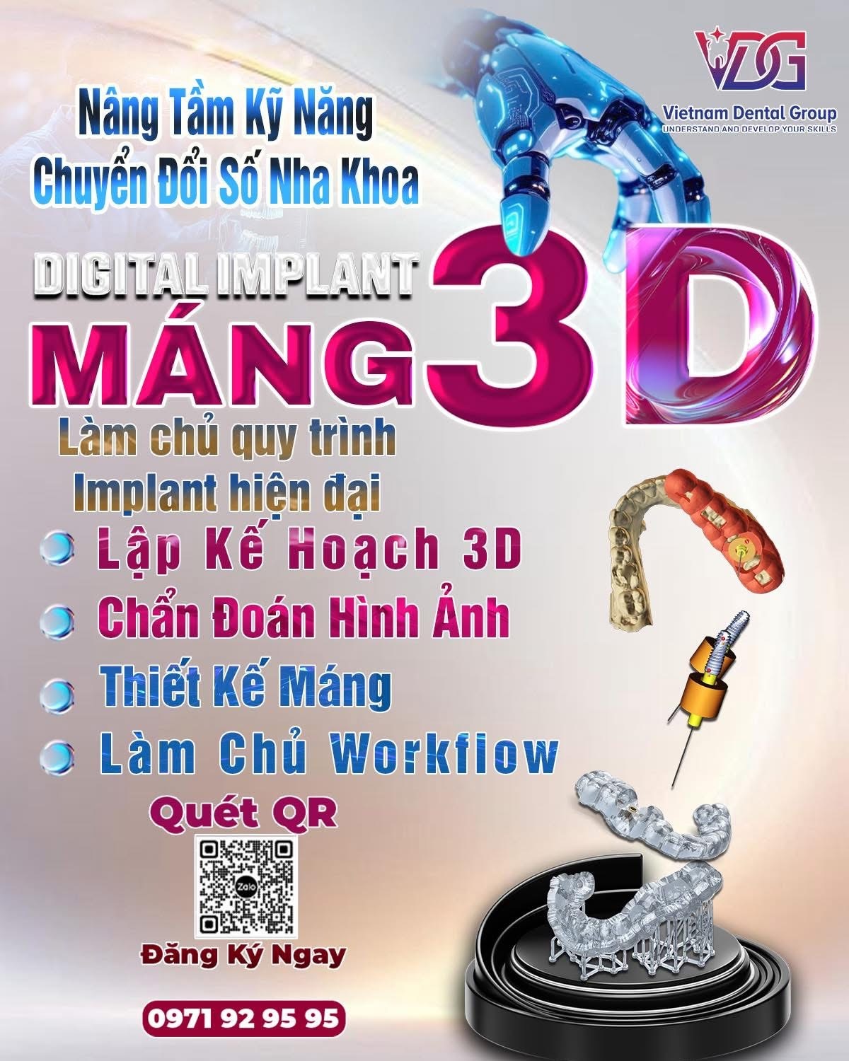 KHÓA HỌC THIẾT KẾ MÁNG IMPLANT 3D- Đào Tạo Thiết Kế & In Máng 3D Tại Phòng Khám